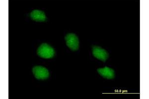 Image no. 2 for anti-Paraneoplastic Antigen MA1 (PNMA1) (AA 1-353) antibody (ABIN522701)