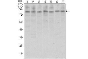 Image no. 1 for anti-CCCTC-Binding Factor (Zinc Finger Protein) (CTCF) antibody (ABIN969071)