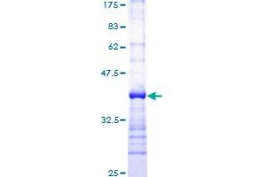 Phospholipase C gamma 1 Protein (phospholipase C, gamma 1) (AA 1192-1291) (GST tag)