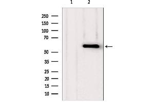 Image no. 2 for anti-phosphoglycerate Dehydrogenase (PHGDH) (N-Term) antibody (ABIN6264177)