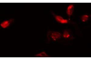 Image no. 2 for anti-Zinc Finger, C3HC-Type Containing 1 (ZC3HC1) (C-Term) antibody (ABIN6263640)