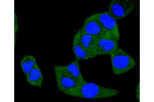 Image no. 3 for anti-V-Raf Murine Sarcoma 3611 Viral Oncogene Homolog (ARAF) antibody (ABIN5557283)