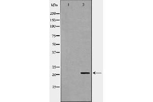 Image no. 3 for anti-Dihydrofolate Reductase (DHFR) antibody (ABIN6261285)