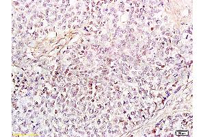 Image no. 1 for anti-High Mobility Group Box 1 (HMGB1) (AA 75-170) antibody (ABIN671616)