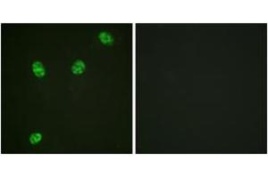 Immunofluorescence analysis of HeLa cells, using ERF (Phospho-Thr526) Antibody.