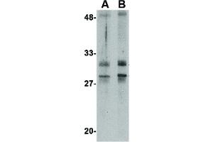 Image no. 2 for anti-Methyltransferase Like 7A (METTL7A) (Internal Region) antibody (ABIN6655974)