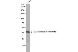 Image no. 8 for anti-Actin, alpha 2, Smooth Muscle, Aorta (ACTA2) (N-Term) antibody (ABIN2857027)