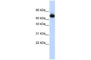 Image no. 1 for anti-Zinc Finger Protein 278 (ZNF278) (Middle Region) antibody (ABIN2780923)