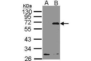 Image no. 1 for anti-Neuroepithelial Cell Transforming 1 (NET1) (C-Term) antibody (ABIN2856317)