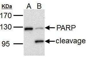 WB Image PARP1 antibody detects PARP1 protein by Western blot analysis.