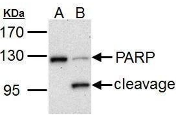 anti-Poly (ADP-Ribose) Polymerase 1 (PARP1) (Center) antibody