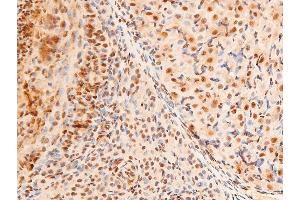 Image no. 3 for anti-Jun Proto-Oncogene (JUN) (pThr91) antibody (ABIN6256604)
