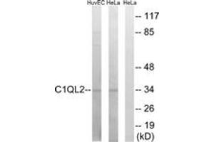 Image no. 1 for anti-Complement Component 1, Q Subcomponent-Like 2 (C1QL2) (AA 231-280) antibody (ABIN1534793)