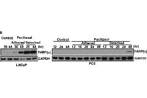 Image no. 74 for anti-Glyceraldehyde-3-Phosphate Dehydrogenase (GAPDH) (Center) antibody (ABIN2857072)