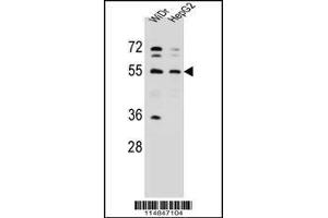 Image no. 3 for anti-Asparaginyl-tRNA Synthetase (NARS) (AA 24-53), (N-Term) antibody (ABIN655041)