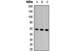 Image no. 1 for anti-Matrix Metallopeptidase 28 (MMP28) (Center) antibody (ABIN2706573)