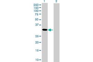 Image no. 1 for anti-Zinc Finger, AN1-Type Domain 3 (ZFAND3) (AA 1-227) antibody (ABIN528462)