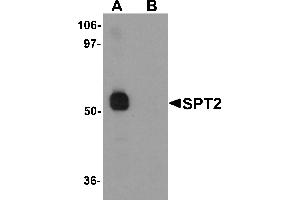 Western blot analysis of SPT2 in 3T3 cell lysate with SPT2 antibody at 1 µg/mL in (A) the absence and (B) the presence of blocking peptide.