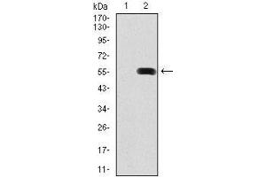 Image no. 4 for anti-Pancreatic and Duodenal Homeobox 1 (PDX1) antibody (ABIN969554)