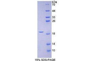 Image no. 1 for Calcitonin-Related Polypeptide alpha (CALCA) (AA 1-127) protein (His tag) (ABIN1821630)