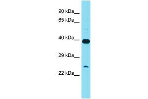 Image no. 1 for anti-XRCC6 Binding Protein 1 (XRCC6BP1) (C-Term) antibody (ABIN2791261)