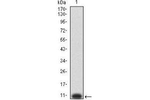 Image no. 2 for anti-Purinergic Receptor P2Y, G-Protein Coupled, 8 (P2RY8) antibody (ABIN5611348)