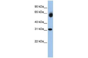 Image no. 2 for anti-Dehydrogenase/reductase (SDR Family) Member 2 (DHRS2) (Middle Region) antibody (ABIN2775325)