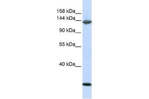 Image no. 1 for anti-Jagged 2 (JAG2) (N-Term) antibody (ABIN634269)