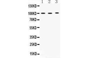 Image no. 1 for anti-ADAM Metallopeptidase Domain 2 (ADAM2) (AA 231-274), (N-Term) antibody (ABIN5518722)