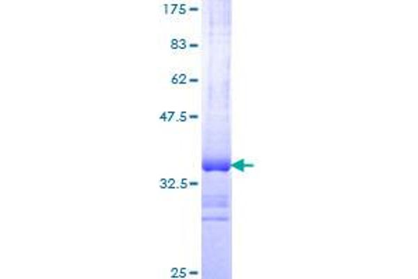 PEX2 Protein (AA 217-305) (GST tag)
