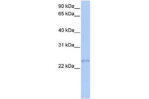Image no. 1 for anti-Transcription Elongation Factor A (SII)-Like 1 (TCEAL1) (Middle Region) antibody (ABIN2776430)