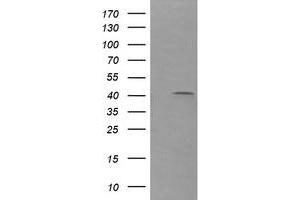 Image no. 2 for anti-Parvin, alpha (PARVA) antibody (ABIN1496443)