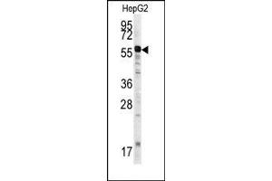 Image no. 1 for anti-Matrix Metalloproteinase 20 (MMP20) (Middle Region) antibody (ABIN358692)