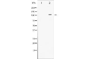 Image no. 1 for anti-Histone Deacetylase 4 (HDAC4) (pSer632) antibody (ABIN6256389)