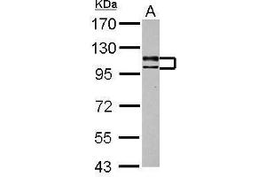Image no. 3 for anti-Ubiquitin Specific Peptidase 4 (USP4) (Center) antibody (ABIN2855588)