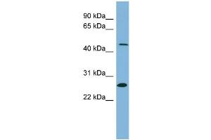 Image no. 1 for anti-Ureidopropionase, beta (UPB1) (Middle Region) antibody (ABIN2775432)