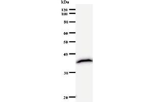 Image no. 1 for anti-Zinc Finger Protein 3 (ZNF3) antibody (ABIN931067)