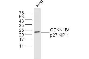 Image no. 3 for anti-Cyclin-Dependent Kinase Inhibitor 1B (p27, Kip1) (CDKN1B) (AA 150-198) antibody (ABIN672621)