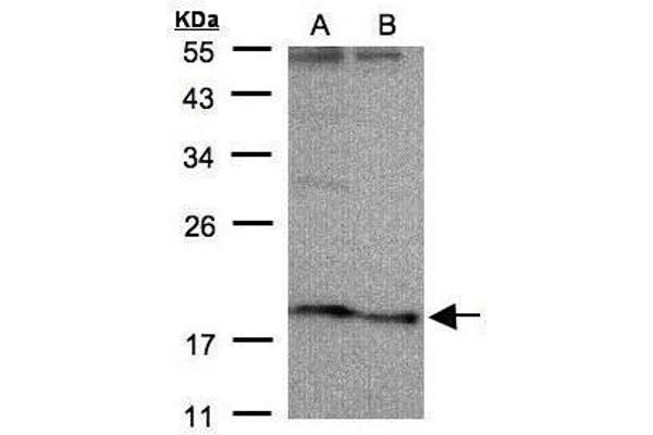 anti-Sodium Channel, Voltage-Gated, Type III, beta Subunit (SCN3B) (Center) antibody