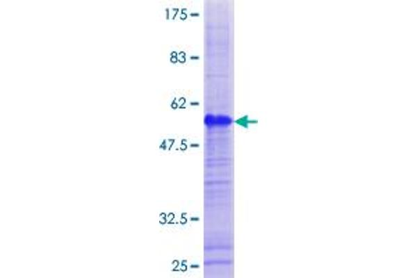 G Antigen 1 (GAGE1) (AA 1-139) protein (GST tag)