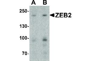 Image no. 1 for anti-Zinc Finger E-Box Binding Homeobox 2 (ZEB2) (C-Term) antibody (ABIN6656978)