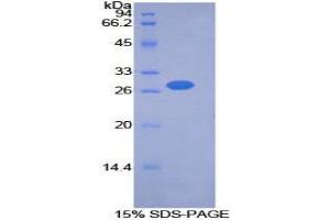 Image no. 1 for Pyruvate Dehydrogenase Kinase, Isozyme 2 (PDK2) (AA 155-379) protein (His tag,T7 tag) (ABIN1877871)