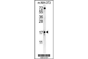 Western Blotting (WB) image for anti-Enhancer of Yellow 2 Homolog (ENY2) antibody (ABIN2158709)