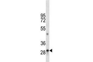 Image no. 1 for anti-Tryptase alpha/beta 1 (TPSAB1) (AA 249-275) antibody (ABIN3029273)