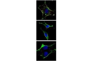 Image no. 1 for anti-Mast/stem Cell Growth Factor Receptor (KIT) antibody (ABIN3028783)