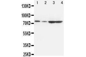 Image no. 1 for anti-Proprotein Convertase Subtilisin/kexin Type 9 (PCSK9) (AA 671-687), (C-Term) antibody (ABIN3042887)