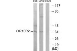 OR10S1 antibody  (AA 213-262)