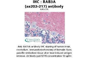 Image no. 2 for anti-RAB3A, Member RAS Oncogene Family (RAB3A) (AA 202-217) antibody (ABIN1738675)