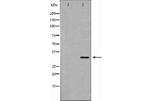 Image no. 1 for anti-alpha-2-Glycoprotein 1, Zinc-Binding (AZGP1) (Internal Region) antibody (ABIN6260166)