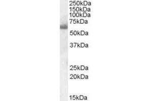 Image no. 2 for anti-SH2 Domain Containing 3A (SH2D3A) (Internal Region) antibody (ABIN570964)